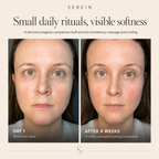 Elara Facial Sculpt Set