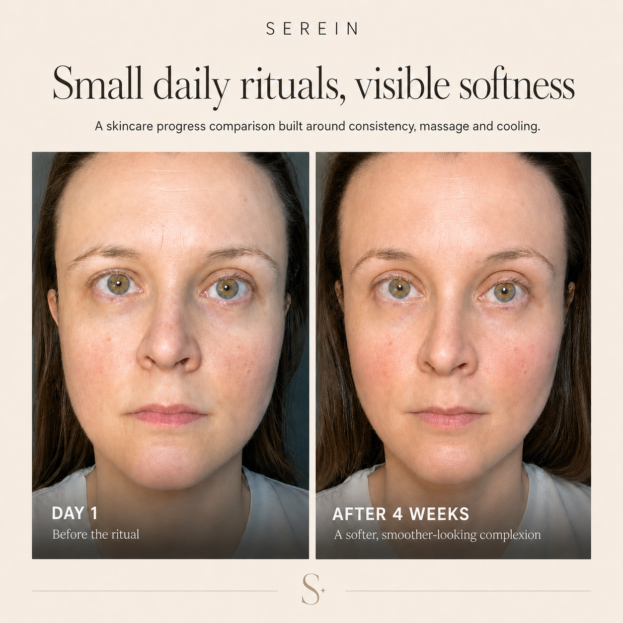 Elara Facial Sculpt Set