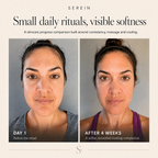 Elara Facial Sculpt Set