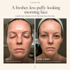 Elara Facial Sculpt Set